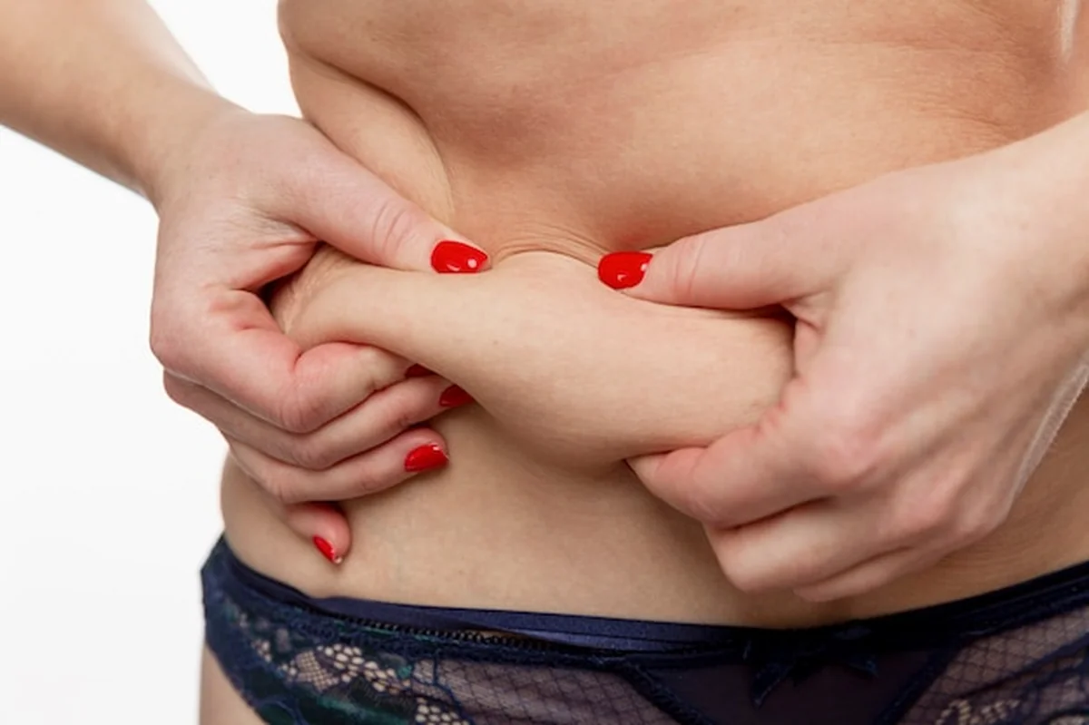 Gruby kobiecy brzuch z fałdami tłuszczu. Otyłość i nadwaga